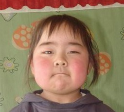 再障康复患者车俏靓