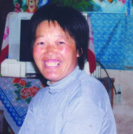 血小板减少症康复患者马爱莲