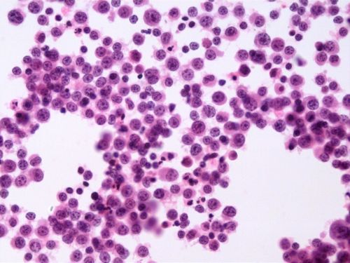 骨髓细胞形态学－正常血细胞形态