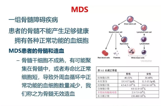 儿童MDS的治疗