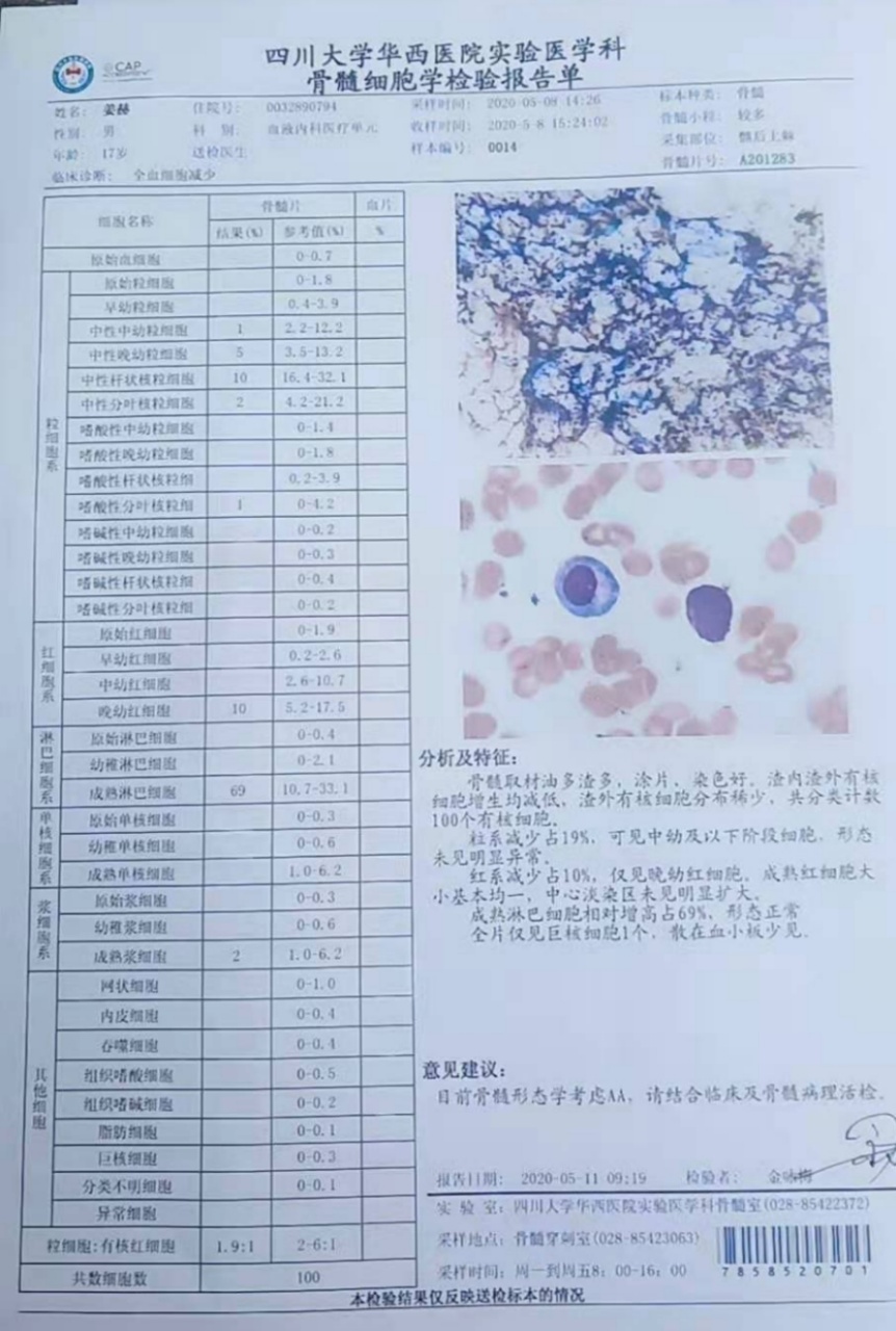 CAA治疗中，效果显著已经脱离输血